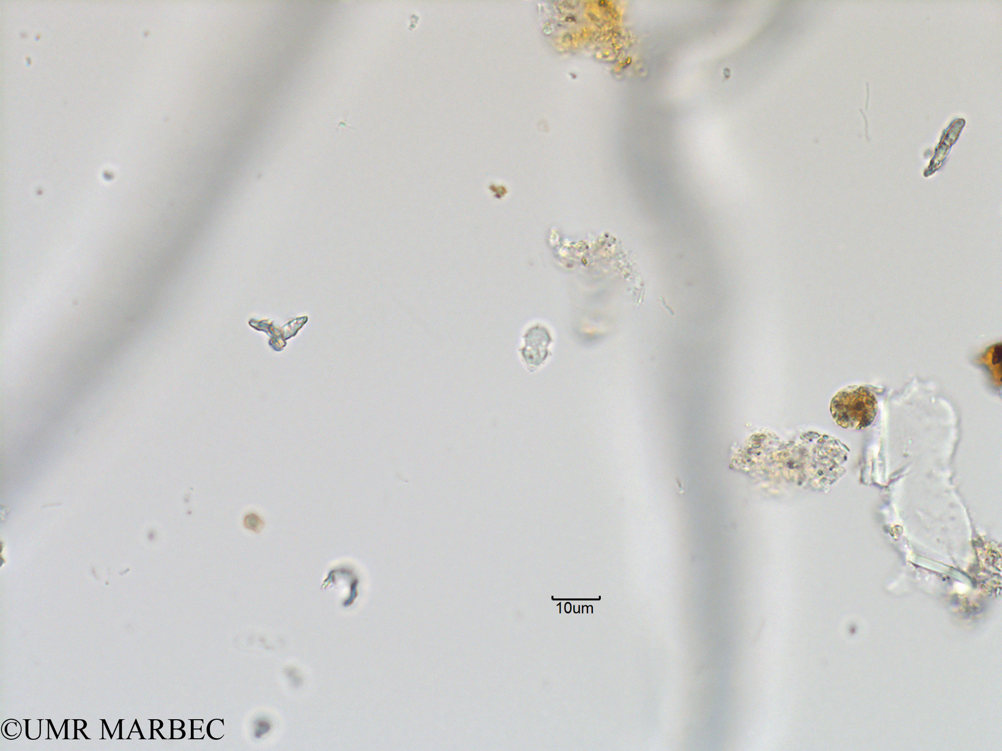 phyto/Bizerte/bizerte_bay/RISCO November 2015/Azadinium spp (Baie_T5-ACW1-Petit dino- cf heterocapsa minima ou azadinium-28).tif(copy).jpg